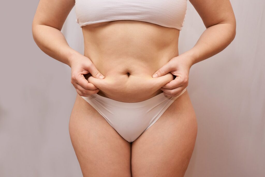 Femme pinçant la graisse du ventre, préoccupation abordée lors du bilan minceur gratuit chez Fit Center à Frameries